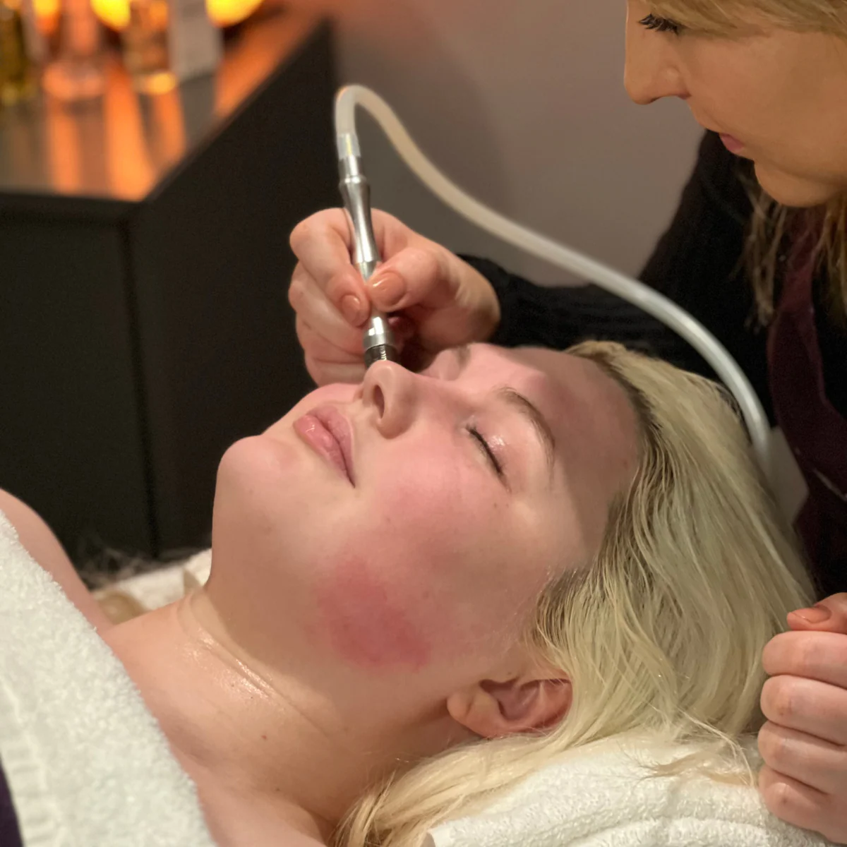 PURE Diamond Peel Facial - 60 min Treatment - Image 3