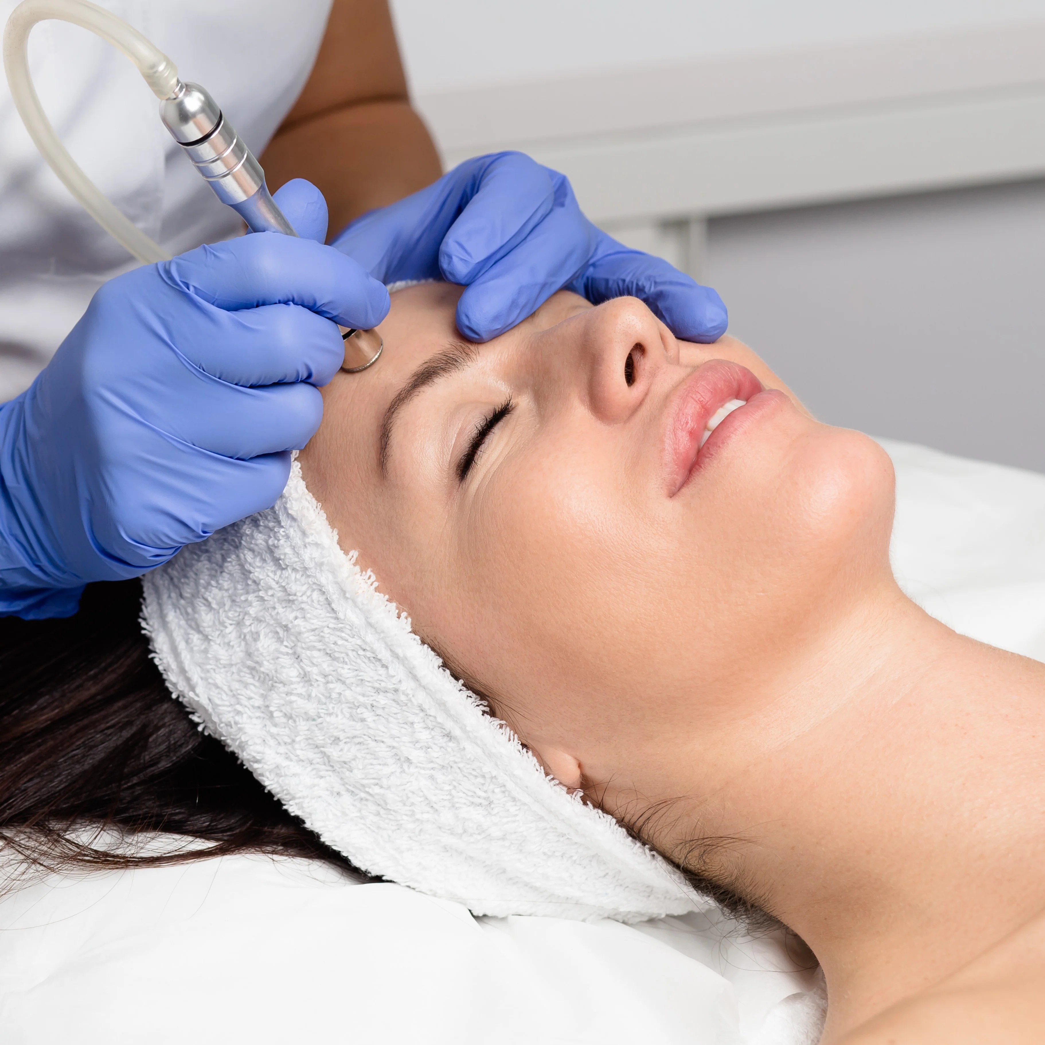 PURE Diamond Peel Facial - 30 min Treatment - Image 4